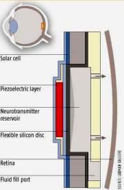 Implante alimentado por energia solar poder restaurar viso