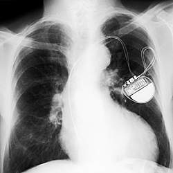 A teoria estava errada: os transistores podem encolher