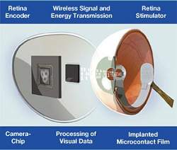 Retinas artificiais aproximam-se do uso prtico