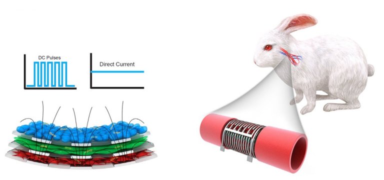 Veias eletrnicas vo monitorar voc por dentro