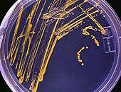 Bactria retm metais pesados de ambientes contaminados