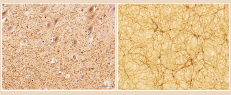 Crebro humano tem semelhanas intrigantes com teia csmica de galxias