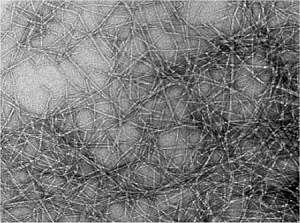 Cientistas vo construir orelha artificial de celulose