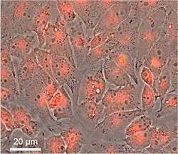 P de caf usado vira material luminescente para Medicina