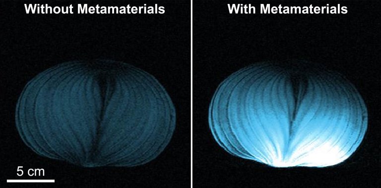 Material que promete revolucionar ressonncia magntica ganha inteligncia