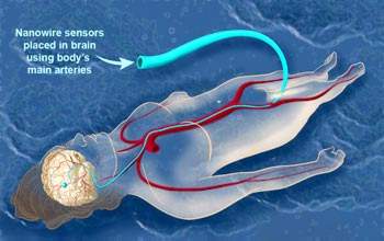 Nanofios podero monitorar e estimular neurnios individuais