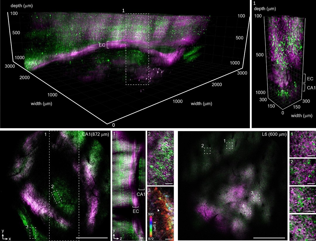 Profundoscpio, o microscpio que promete revolucionar a neurocincia