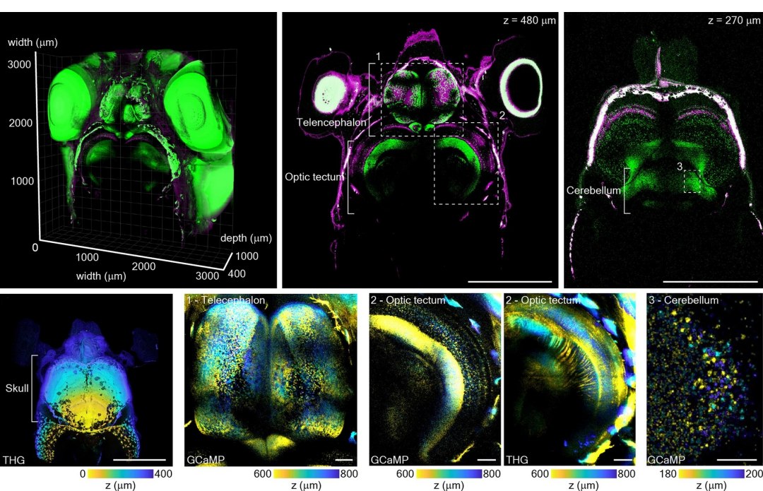 Profundoscpio, o microscpio que promete revolucionar a neurocincia