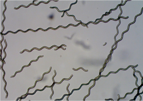 Microrrobs feitos com alga tratam doena em cobaias