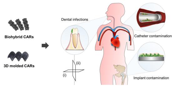 Enxame de microrrobs limpa placa dental